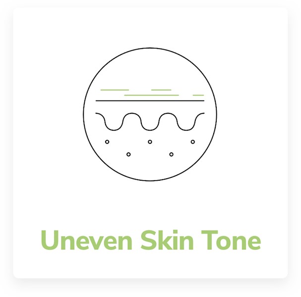 uneven skin tone